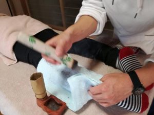 棒灸の施術